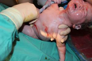 delivering a baby